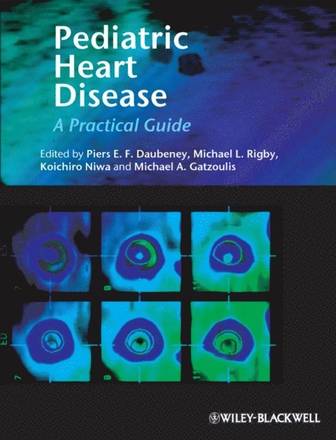 Koichiro Niwa, Michael Gatzoulis, Michael Rigby, Piers Daubeney - Pediatric Heart Disease, E-bok