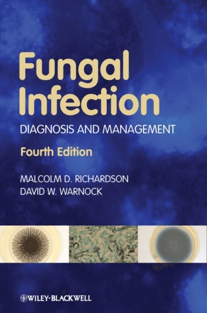 David W. Warnock, Malcolm D. Richardson - Fungal Infection, E-bok