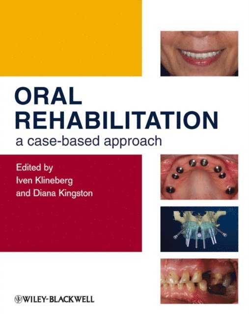Diana Kingston, Iven Klineberg - Oral Rehabilitation, E-bok. Tillgänglighet: Lägg i varukorg