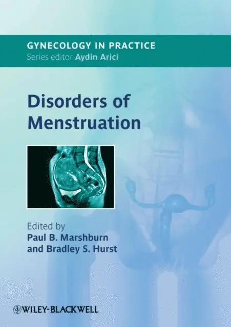 Bradley Hurst, Paul Marshburn - Disorders of Menstruation, E-bok. Tillgänglighet: Lägg i varukorg