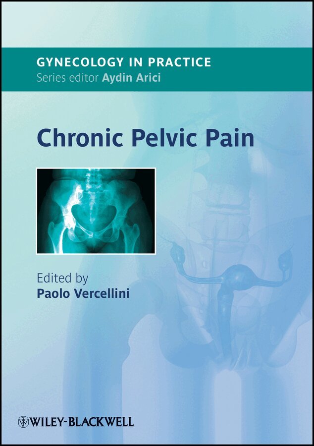 Paolo Vercellini - Chronic Pelvic Pain. Tillgänglighet: Tillfälligt slut