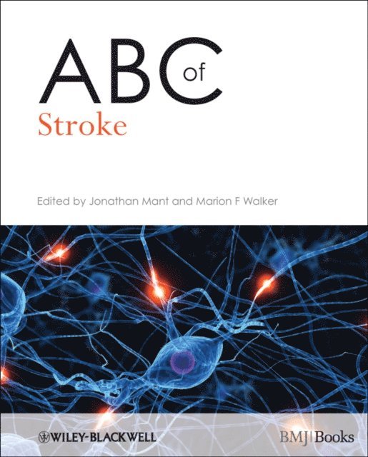 Marion F. Walker, Jonathan Mant - ABC of Stroke, E-bok