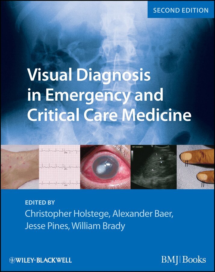 Christopher P. Holstege, Alexander B. Baer, Jesse M. Pines, William J. Brady - Visual Diagnosis in Emergency and Critical Care Medicine. Tillgänglighet: Tillfälligt slut