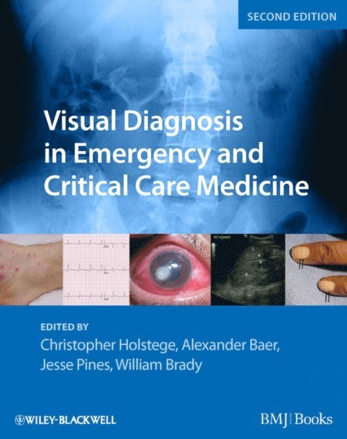 William J. Brady, Jesse M. Pines, Alexander B. Baer, Christopher P. Holstege - Visual Diagnosis in Emergency and Critical Care Medicine, E-bok