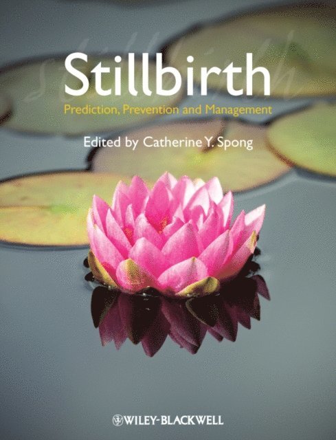 Catherine Y. Spong - Stillbirth, E-bok