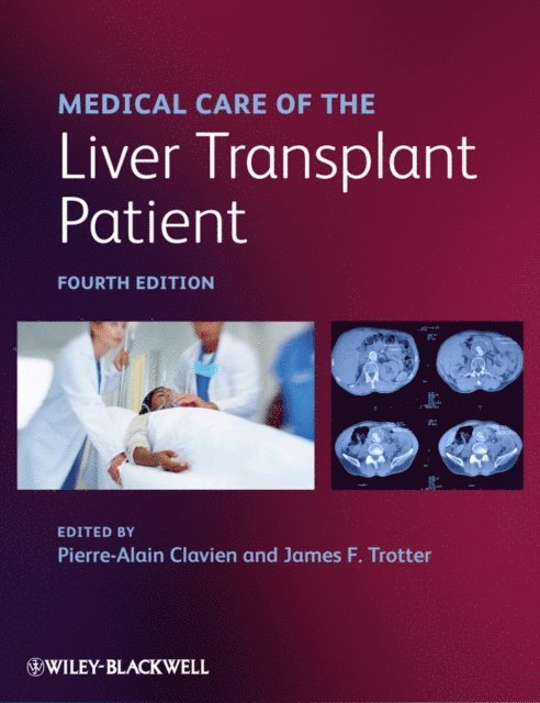 James F. Trotter, Pierre-Alain Clavien - Medical Care of the Liver Transplant Patient, E-bok