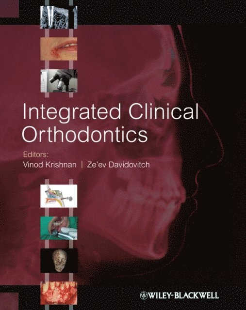 Ze'ev Davidovitch, Vinod Krishnan - Integrated Clinical Orthodontics, E-bok