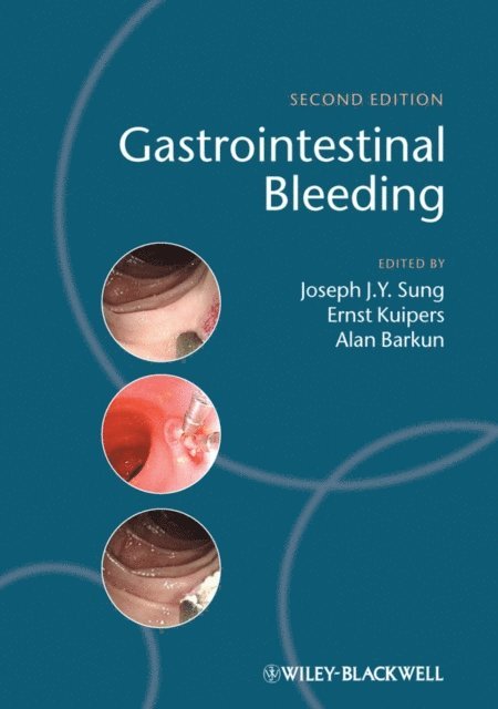 Alan Barkun, Ernst Kuipers, Joseph J. Y. Sung - Gastrointestinal Bleeding, E-bok