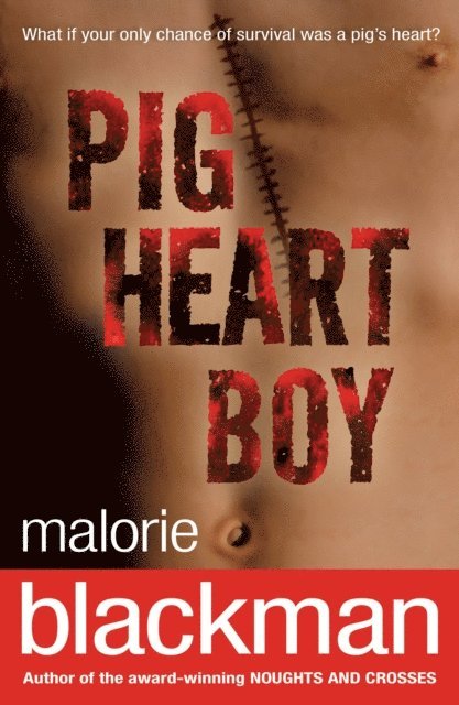 Malorie Blackman - Pig-Heart Boy, E-bok