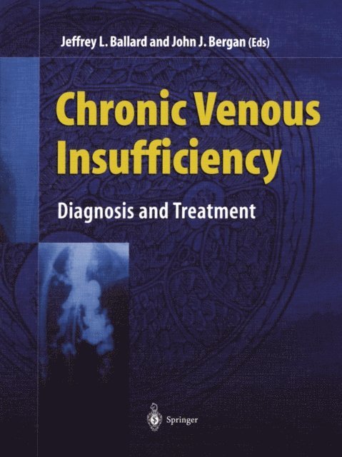 John Bergan, Jeffrey L. Ballard - Chronic Venous Insufficiency, E-bok