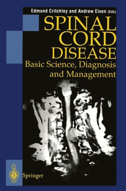 Andrew Eisen, Edmund Critchley - Spinal Cord Disease, E-bok