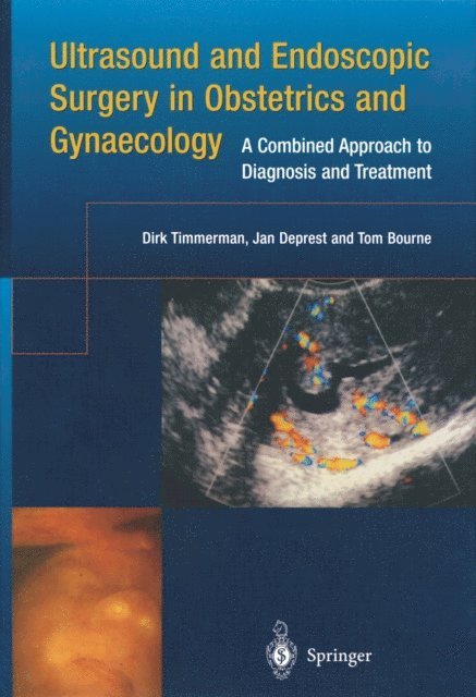 Tom Bourne, Jan Deprest, Dirk Timmerman - Ultrasound and Endoscopic Surgery in Obstetrics and Gynaecology, E-bok