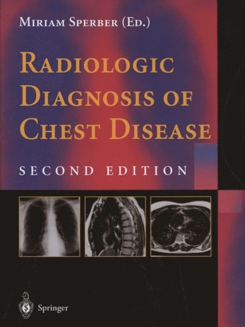 Miriam Sperber - Radiologic Diagnosis of Chest Disease, E-bok. Tillgänglighet: Lägg i varukorg