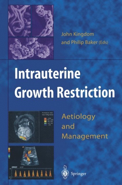 Philip Baker, John Kingdom - Intrauterine Growth Restriction, E-bok