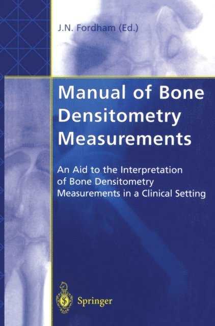 John N. Fordham - Manual of Bone Densitometry Measurements, E-bok. Tillgänglighet: Lägg i varukorg