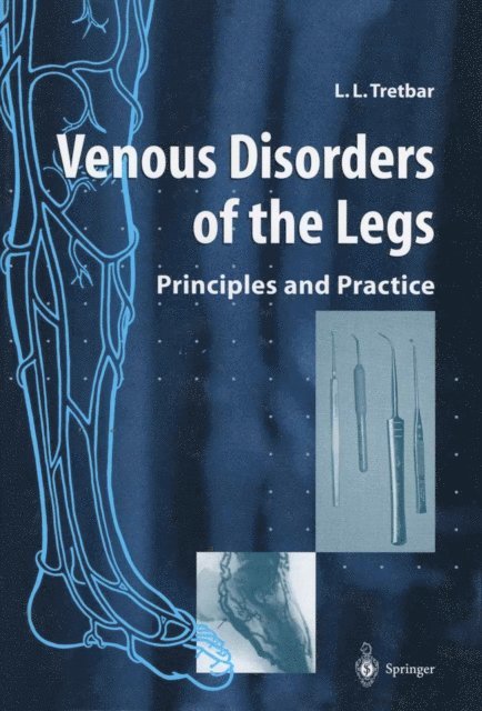 Lawrence L. Tretbar - Venous Disorders of the Legs, E-bok