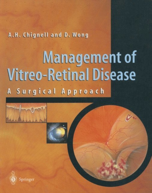 David Wong, Anthony Chignell - Management of Vitreo-Retinal Disease, E-bok