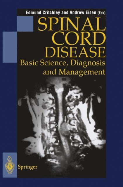 Andrew A. Eisen, Edmund Critchley - Spinal Cord Disease, E-bok