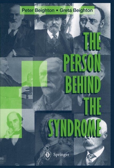 Greta Beighton - Person Behind the Syndrome, E-bok