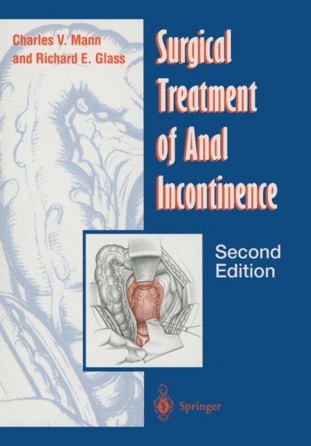 Richard E. Glass, Charles V. Mann - Surgical Treatment of Anal Incontinence, E-bok