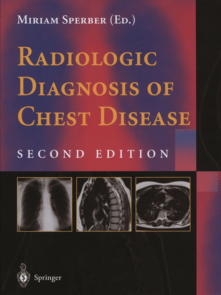 Miriam Sperber - Radiologic Diagnosis of Chest Disease, Häftad. Tillgänglighet: Lägg i varukorg