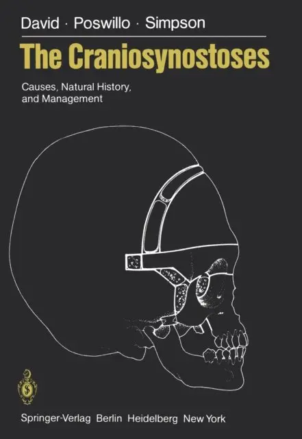 D. Simpson, D. Poswillo, David J. David - Craniosynostoses, E-bok. Tillgänglighet: Lägg i varukorg