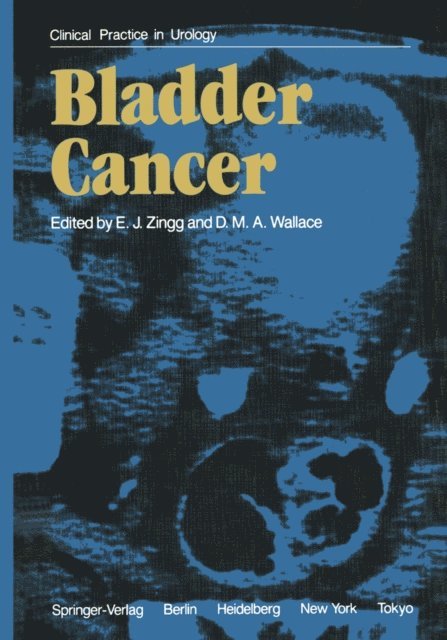 D.M.A. Wallace, E.J. Zingg - Bladder Cancer, E-bok