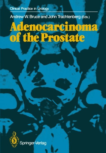 John Trachtenberg, Andrew W. Bruce - Adenocarcinoma of the Prostate, E-bok