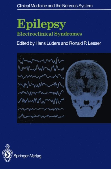 Ronald P. Lesser, Hans Luders - Epilepsy, E-bok