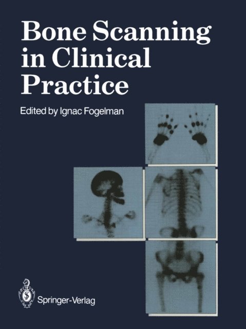 Ignac Fogelman - Bone Scanning in Clinical Practice, E-bok