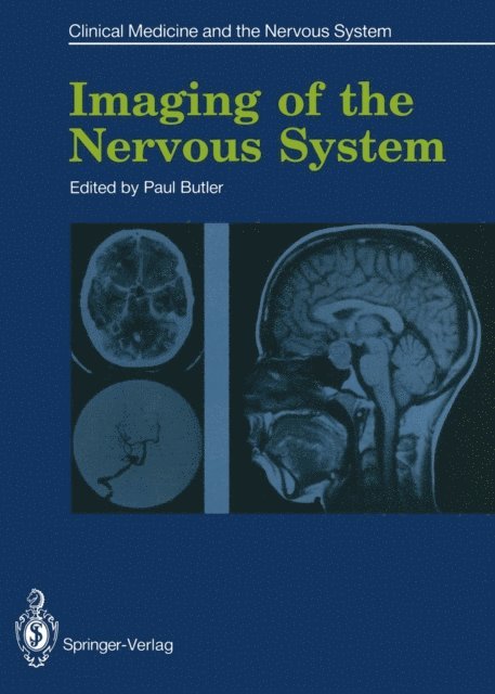 Paul Butler - Imaging of the Nervous System, E-bok