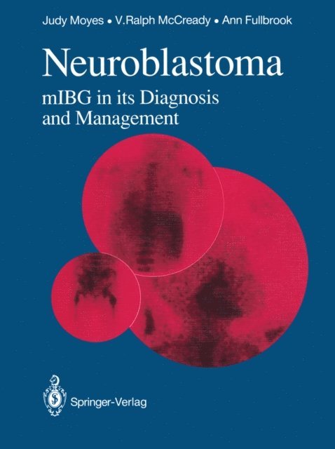 Ann C. Fullbrook, V. Ralph McCready, Judy S.E. Moyes - Neuroblastoma, E-bok