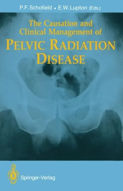 Eric W. Lupton, Philip F. Schofield - Causation and Clinical Management of Pelvic Radiation Disease, E-bok. Tillgänglighet: Lägg i varukorg