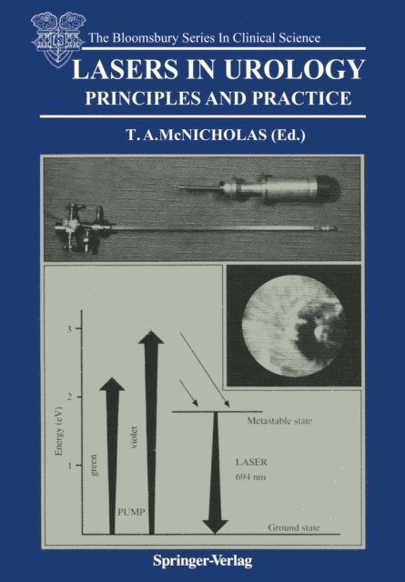Thomas A. McNicholas - Lasers in Urology, E-bok