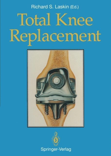 Richard S. Laskin - Total Knee Replacement, E-bok