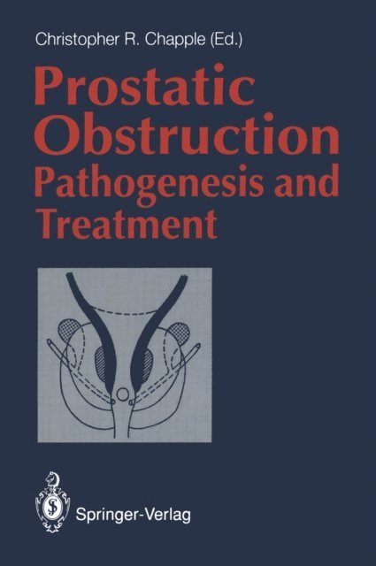 Christopher R. Chapple - Prostatic Obstruction, E-bok