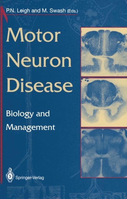 Michael Swash, P.N. Leigh - Motor Neuron Disease, E-bok