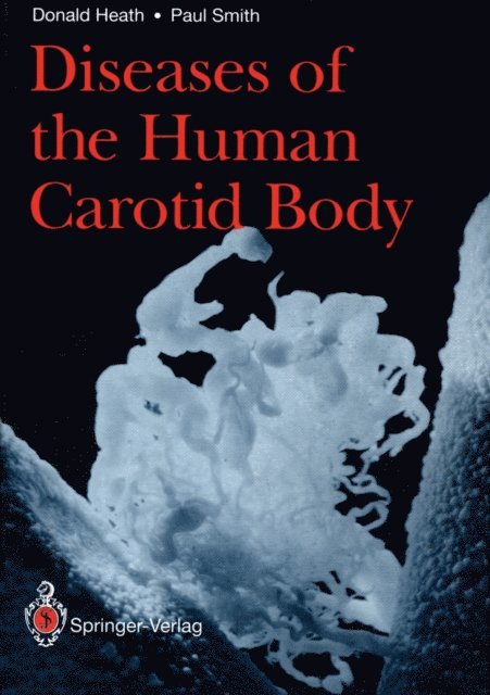 Paul Smith, Donald Heath - Diseases of the Human Carotid Body, E-bok