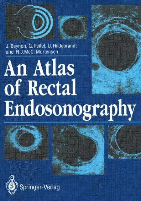 Neil Mortensen, Ulrich Hildebrandt, Gernot Feifel, John Beynon - Atlas of Rectal Endosonography, E-bok