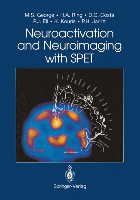 Peter H. Jarritt, Kypros Kouris, Peter J. Ell, Durval C. Costa, Howard A. Ring, Mark S. George - Neuroactivation and Neuroimaging with SPET, E-bok
