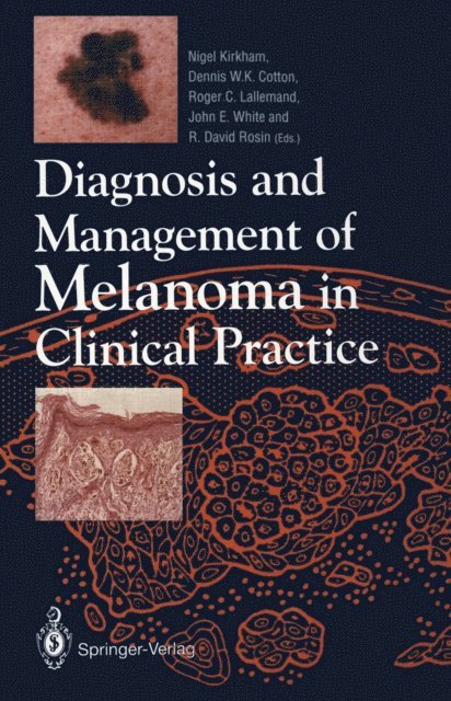 R. David Rosin, John E. White, Roger C. Lallemand, Dennis W.K. Cotton, Nigel Kirkham - Diagnosis and Management of Melanoma in Clinical Practice, E-bok. Tillgänglighet: Lägg i varukorg