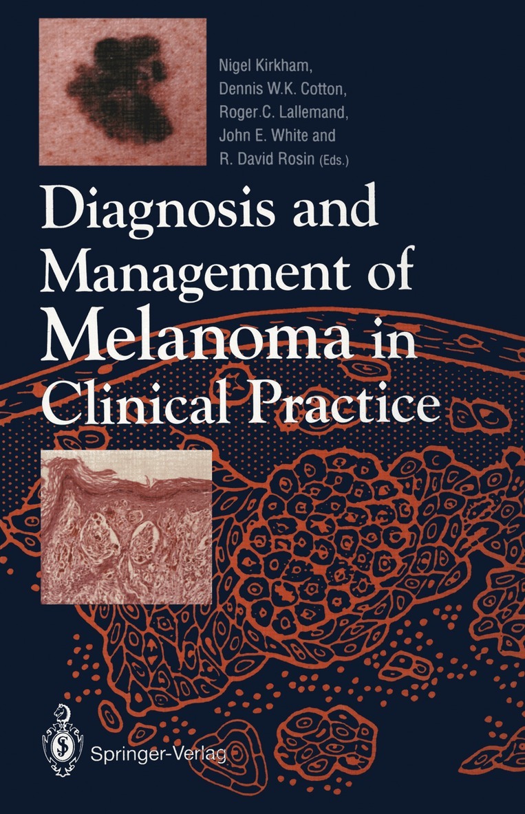 Nigel Kirkham, Dennis W.K. Cotton, Roger C. Lallemand, John E. White, R. David Rosin - Diagnosis and Management of Melanoma in Clinical Practice, Häftad. Tillgänglighet: Lägg i varukorg