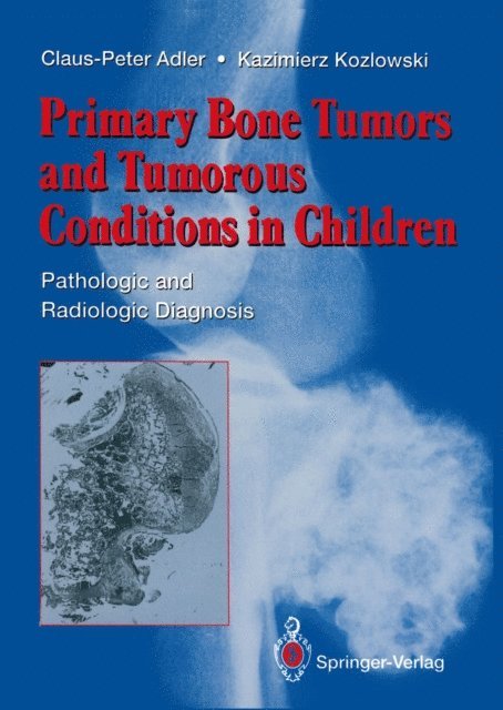 Kazimierz Kozlowski, Claus-Peter Adler - Primary Bone Tumors and Tumorous Conditions in Children, E-bok