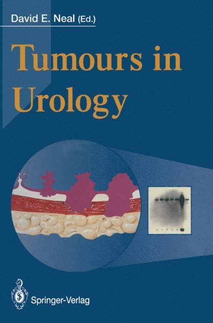 David E. Neal - Tumours in Urology, E-bok