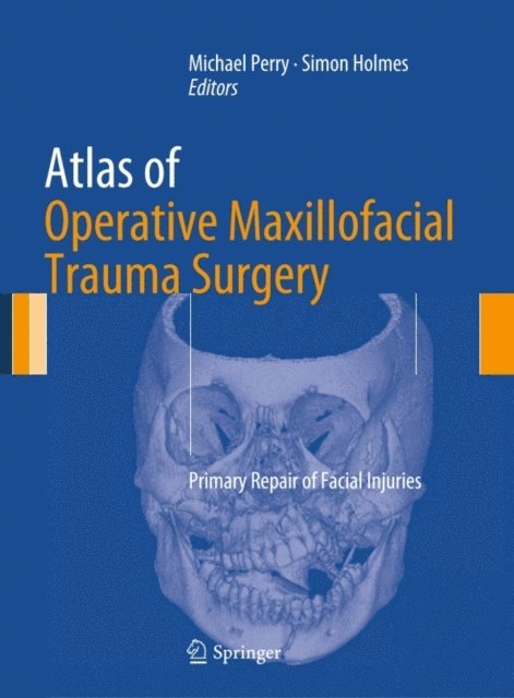 Simon Holmes, Michael Perry - Atlas of Operative Maxillofacial Trauma Surgery, E-bok