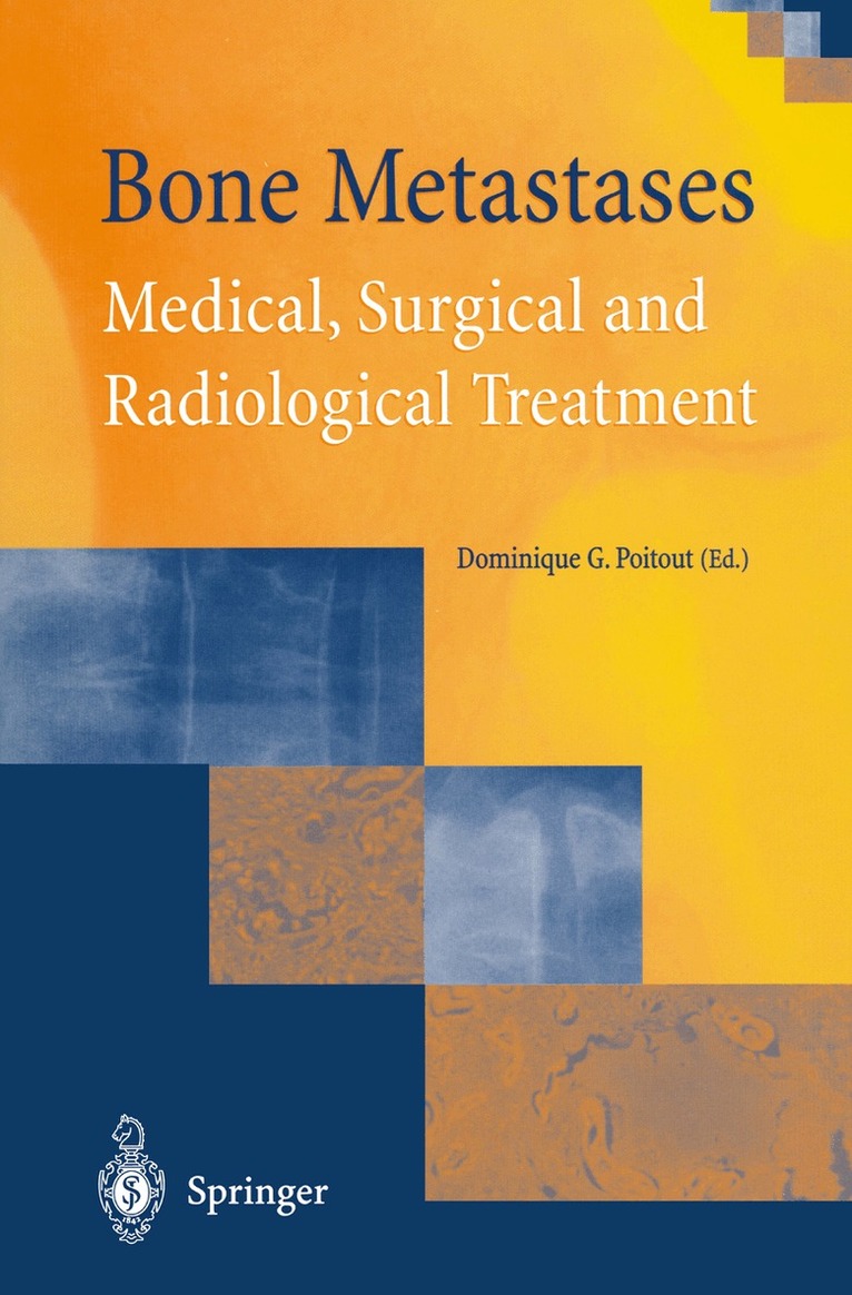 Dominique G. Poitout - Bone Metastases, Häftad