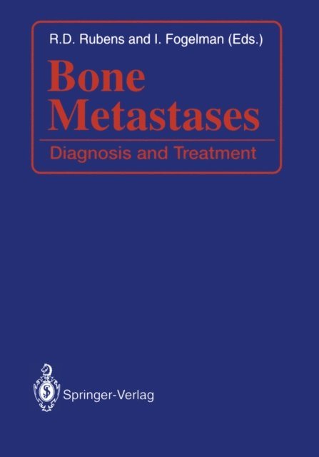 Ignac Fogelman, Robert D. Rubens - Bone Metastases, E-bok