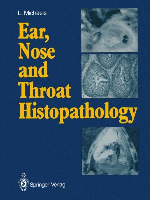 Leslie Michaels - Ear, Nose and Throat Histopathology, E-bok