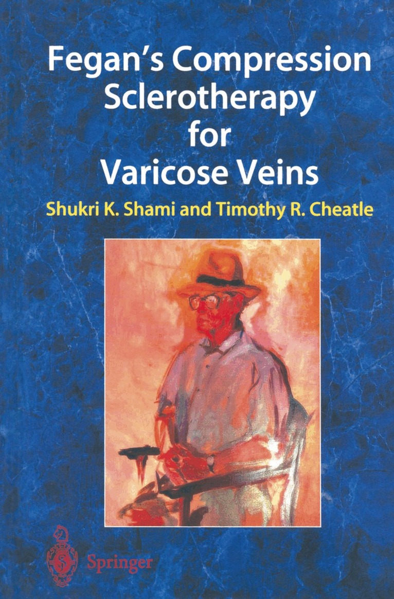 Fegan's Compression Sclerotherapy for Varicose Veins