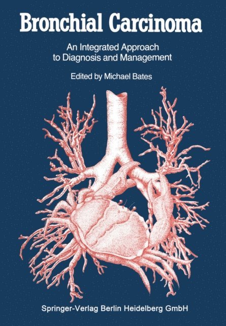 Michael Bates - Bronchial Carcinoma, E-bok